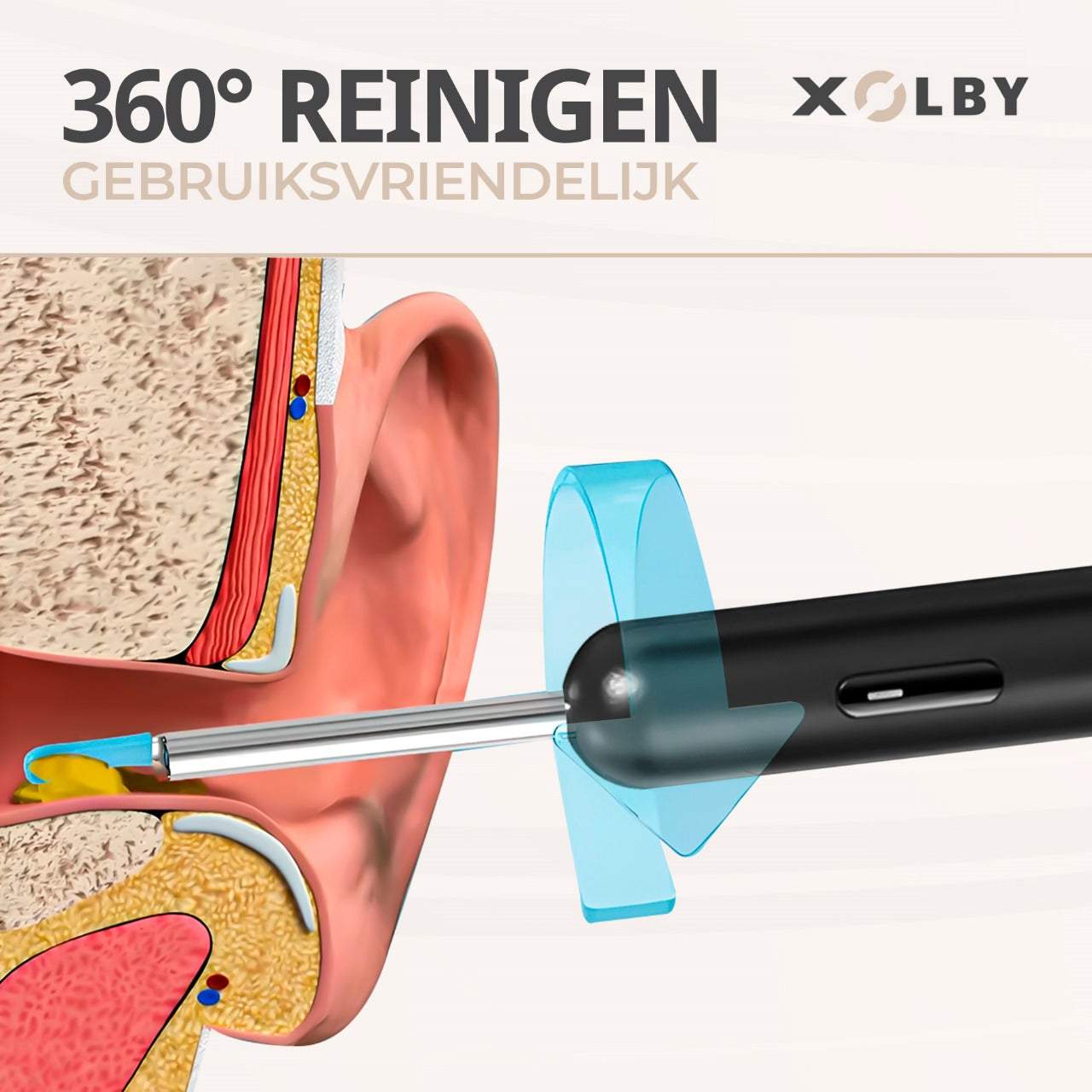 Xolby® Oorsmeerverwijderaar